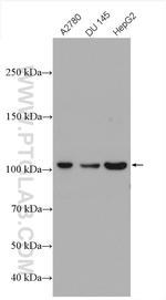 IDE Antibody in Western Blot (WB)