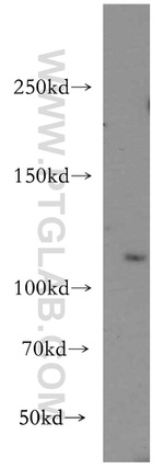 PI3K p110(beta) Antibody in Western Blot (WB)