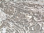 CARD11 Antibody in Immunohistochemistry (Paraffin) (IHC (P))