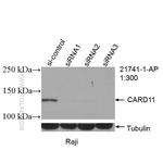CARD11 Antibody in Western Blot (WB)