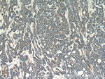 APC1 Antibody in Immunohistochemistry (Paraffin) (IHC (P))