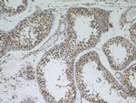 APC1 Antibody in Immunohistochemistry (Paraffin) (IHC (P))