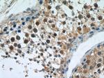 APC1 Antibody in Immunohistochemistry (Paraffin) (IHC (P))