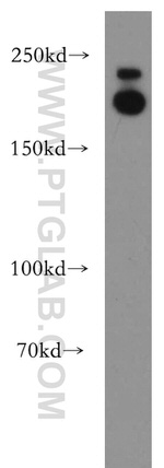 APC1 Antibody in Western Blot (WB)