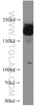 APC1 Antibody in Western Blot (WB)
