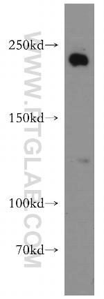 APC1 Antibody in Western Blot (WB)