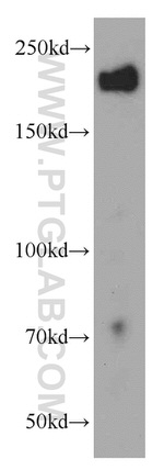 APC1 Antibody in Western Blot (WB)