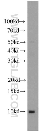 HIGD1A Antibody in Western Blot (WB)