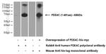 PDE4C Antibody in Western Blot (WB)