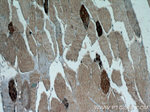 HSPB2 Antibody in Immunohistochemistry (Paraffin) (IHC (P))