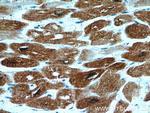 HSPB2 Antibody in Immunohistochemistry (Paraffin) (IHC (P))