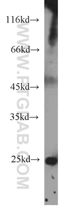 HSPB2 Antibody in Western Blot (WB)