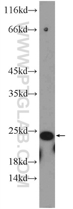 HSPB2 Antibody in Western Blot (WB)