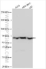 ANAPC7 Antibody in Western Blot (WB)
