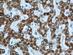 SLC25A2 Antibody in Immunohistochemistry (Paraffin) (IHC (P))