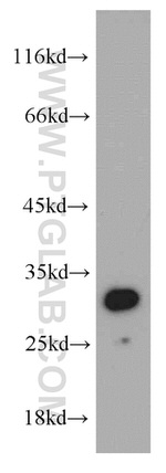 SLC25A2 Antibody in Western Blot (WB)