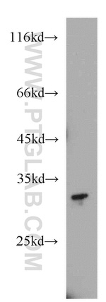SLC25A2 Antibody in Western Blot (WB)
