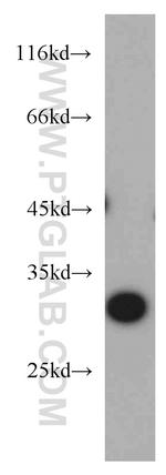 SLC25A2 Antibody in Western Blot (WB)