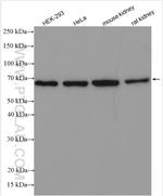 FAM117B Antibody in Western Blot (WB)