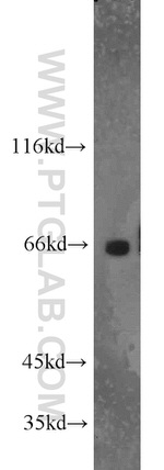 FAM117B Antibody in Western Blot (WB)