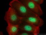DPF1 Antibody in Immunocytochemistry (ICC/IF)