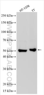 PNMA5 Antibody in Western Blot (WB)