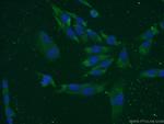 LCE1B Antibody in Immunocytochemistry (ICC/IF)