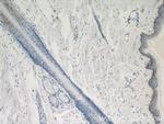 LCE1B Antibody in Immunohistochemistry (Paraffin) (IHC (P))