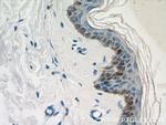 LCE1B Antibody in Immunohistochemistry (Paraffin) (IHC (P))