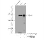 ZO-1 Antibody in Immunoprecipitation (IP)
