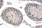 ID4 Antibody in Immunohistochemistry (Paraffin) (IHC (P))