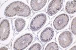 ID4 Antibody in Immunohistochemistry (Paraffin) (IHC (P))