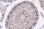 ID4 Antibody in Immunohistochemistry (Paraffin) (IHC (P))