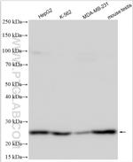 ID4 Antibody in Western Blot (WB)