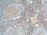 CD52 Antibody in Immunohistochemistry (Paraffin) (IHC (P))