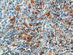 CD52 Antibody in Immunohistochemistry (Paraffin) (IHC (P))