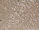 CEP152 Antibody in Immunohistochemistry (Paraffin) (IHC (P))