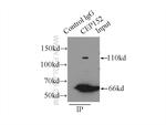 CEP152 Antibody in Immunoprecipitation (IP)