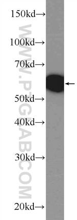 CEP152 Antibody in Western Blot (WB)