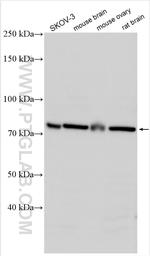 ZP2 Antibody in Western Blot (WB)