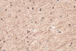 TRPM2 Antibody in Immunohistochemistry (Paraffin) (IHC (P))