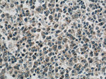 ROCK1 Antibody in Immunohistochemistry (Paraffin) (IHC (P))