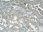 ROCK1 Antibody in Immunohistochemistry (Paraffin) (IHC (P))