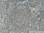 ROCK1 Antibody in Immunohistochemistry (Paraffin) (IHC (P))