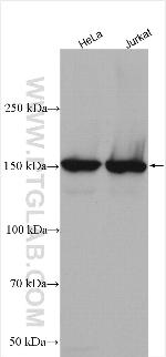 ROCK1 Antibody in Western Blot (WB)