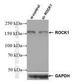 ROCK1 Antibody in Western Blot (WB)