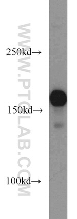 ROCK1 Antibody in Western Blot (WB)