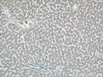 SOAT2 Antibody in Immunohistochemistry (Paraffin) (IHC (P))