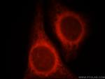 NR3C2 Antibody in Immunocytochemistry (ICC/IF)