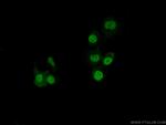 SAFB Antibody in Immunocytochemistry (ICC/IF)